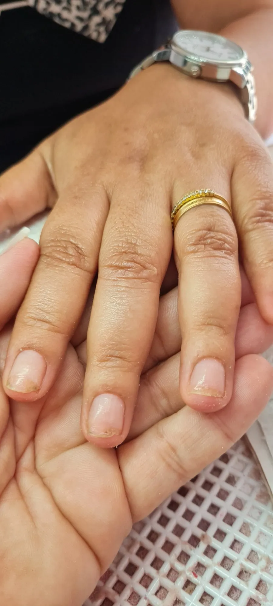 Unhas fracas, finas e com as pontas lascadas